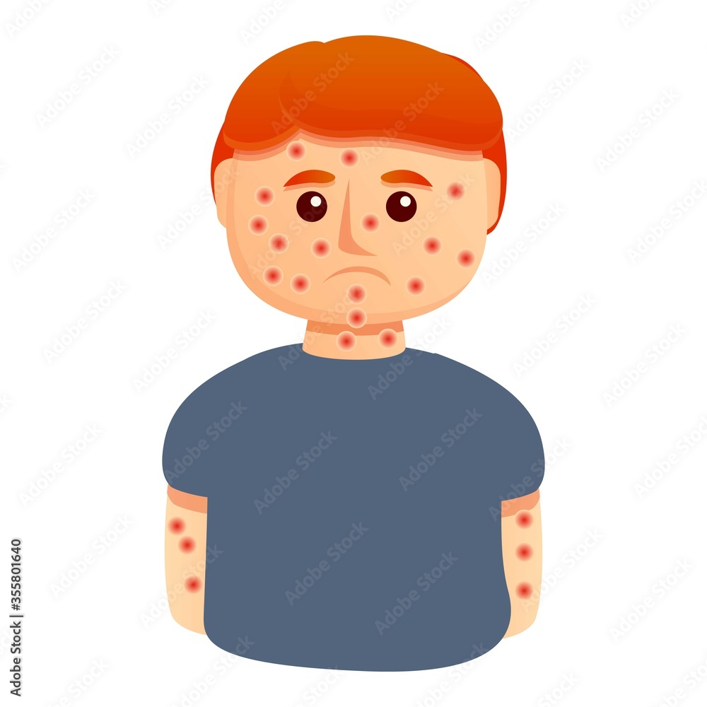 Chicken pox boy icon. Cartoon of chicken pox boy vector icon for web design isolated on white background Chicken pox boy icon. Cartoon of chicken pox boy vector icon for web design isolated on white background