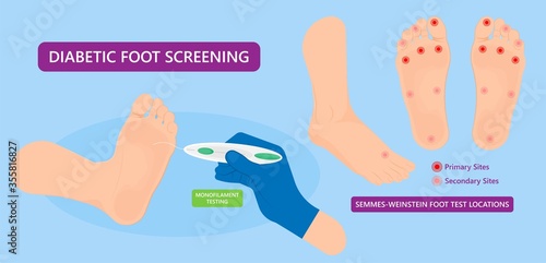 Vacuum assisted closure VAC drain tube treat dead damage pain medicine sealing healing diagnose exam technique surgery therapeutic suction high blood sugar test feet leg level loss air body Venous