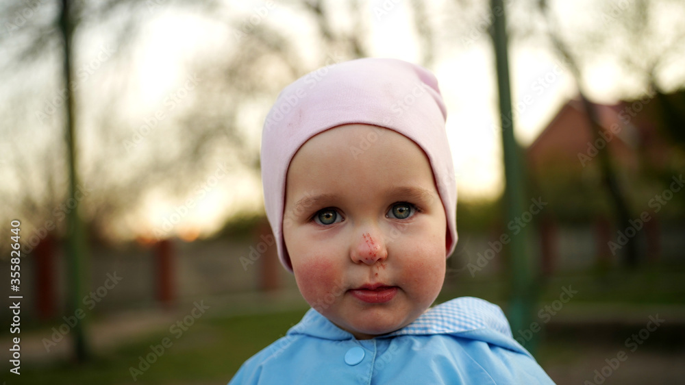 Upset little girl in blue jumpsuit with scratch on her nose Upset little girl in blue jumpsuit with scratch on her nose