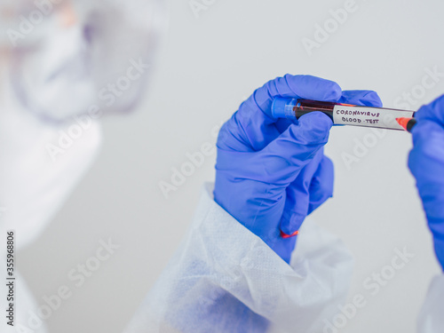 COVID-19. Communicable disease Covid19 or coronavirus.