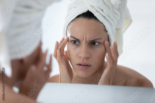 Fotografi Close up unhappy woman wearing white bath towel checking skin after shower, look