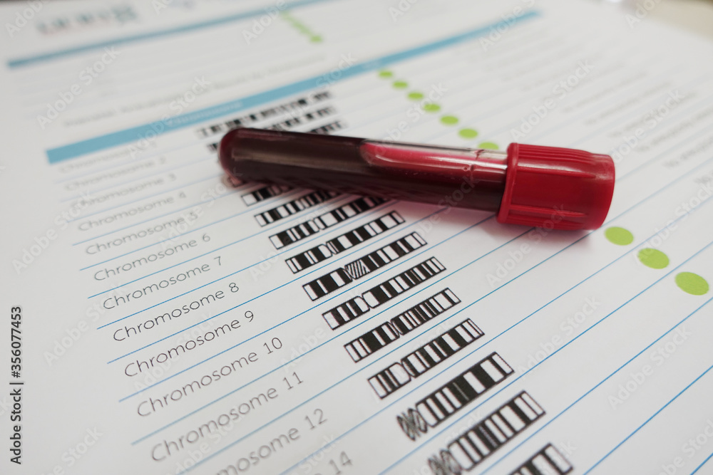 Blood for chromosome testing in laboratory Blood for chromosome testing in laboratory