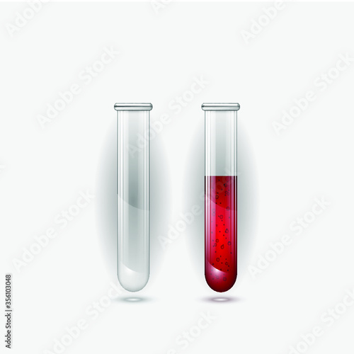 test tube with blood