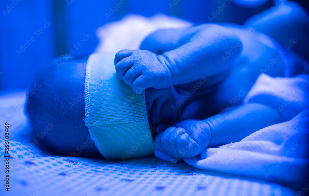 Newborn having a treatment for jaundice under ultraviolet light, Baby