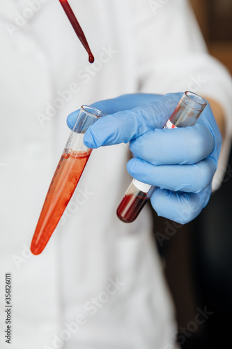 Hands in blue glove scientist or lab technologist working in university research laboratory,rapid test for blood testing in science room hospital,dropping sample blood in plate for dengue vintage tone