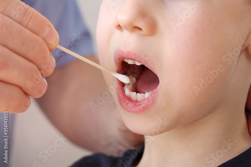 doctor takes a cotton bud from child’s mouth to analyze the saliva, mucous membrane for DNA tests, COVID-19, to determine paternity or presence of virus, concept