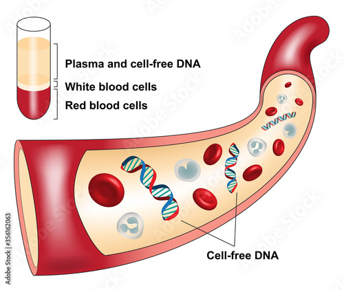 Cell free DNA circulates freely in the blood and can be isolated from the blood plasma
