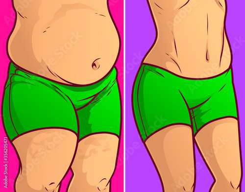 Belly fat, before-after. Vector illustration