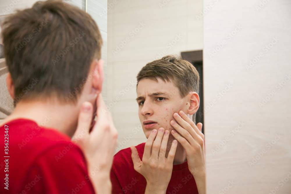 Close up of young attractive man with problematic skin and scars from acne looks in the mirror in the bathroom Close up of young attractive man with problematic skin and scars from acne looks in the mirror in the bathroom