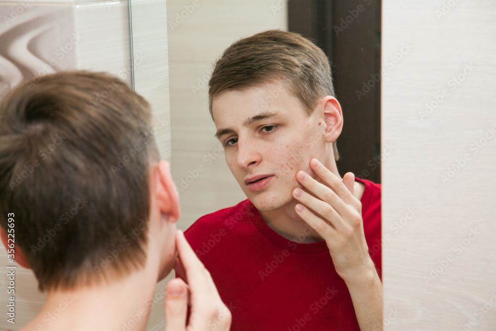 Close up of young attractive man with problematic skin and scars from acne looks in the mirror in the bathroom Close up of young attractive man with problematic skin and scars from acne looks in the mirror in the bathroom