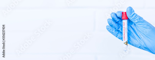 Hand holds a test tube containing a blood sample, test tube with blood for Covid-19 (coronavirus) analyzing