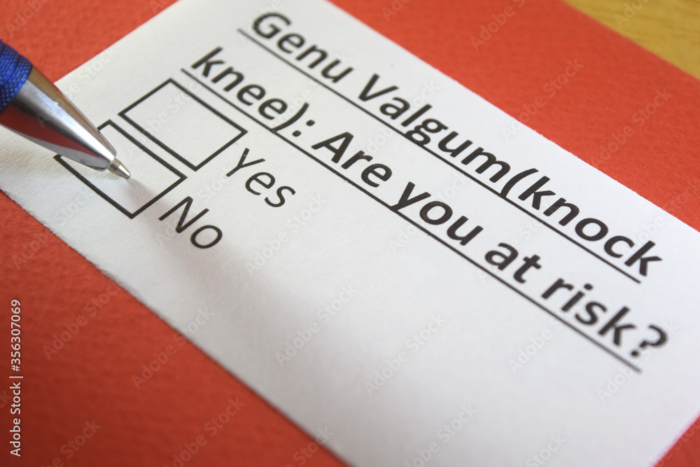 Obraz premium One person is answering question about genu valgum.