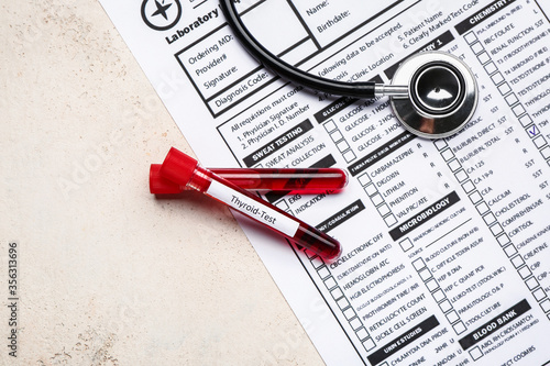 Blood samples in tubes with...