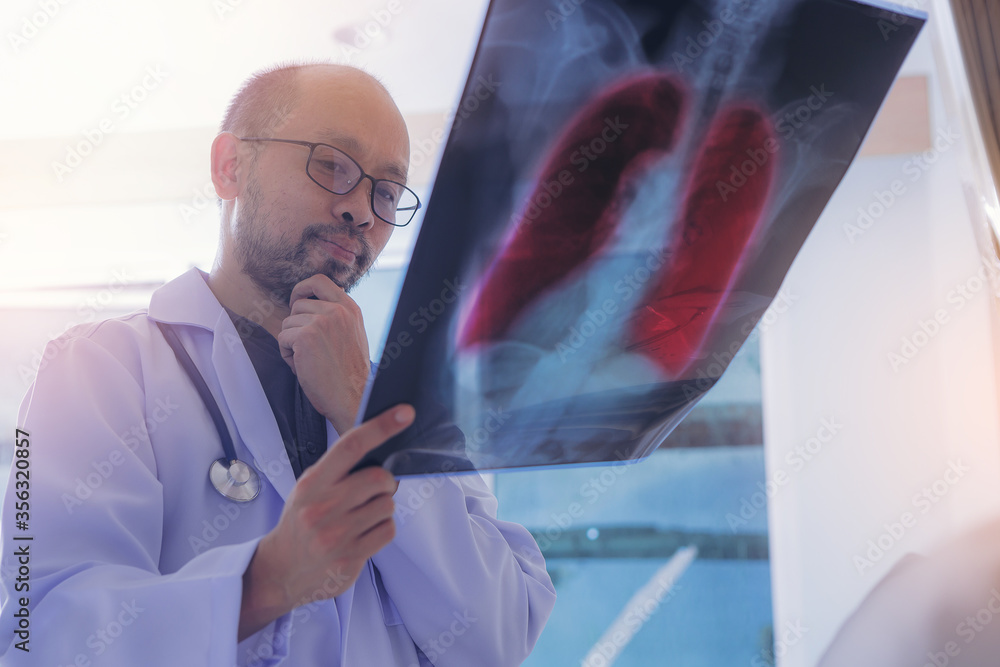 Doctor with examine chest x-ray film for pneumonia of a Covid-19 (Coronavirus) patient at ward hospital. Doctor with examine chest x-ray film for pneumonia of a Covid-19 (Coronavirus) patient at ward hospital.