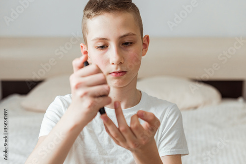 Φωτογραφία Teen boy takes a blood sample for diabetes with lancet pen