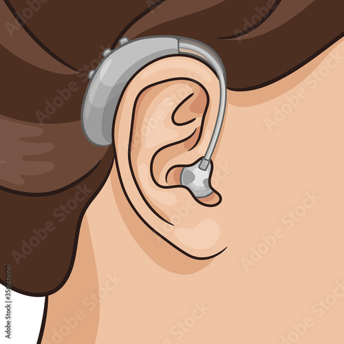 Hearing aid behind the ear, electronic device, BTE type. Hearing loss vector illustration, realistic style