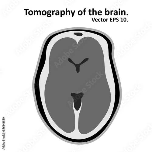 Magnetic resonance imaging of the brain. Cross section of the brain with MRI / CT scan. Vector EPS10.
