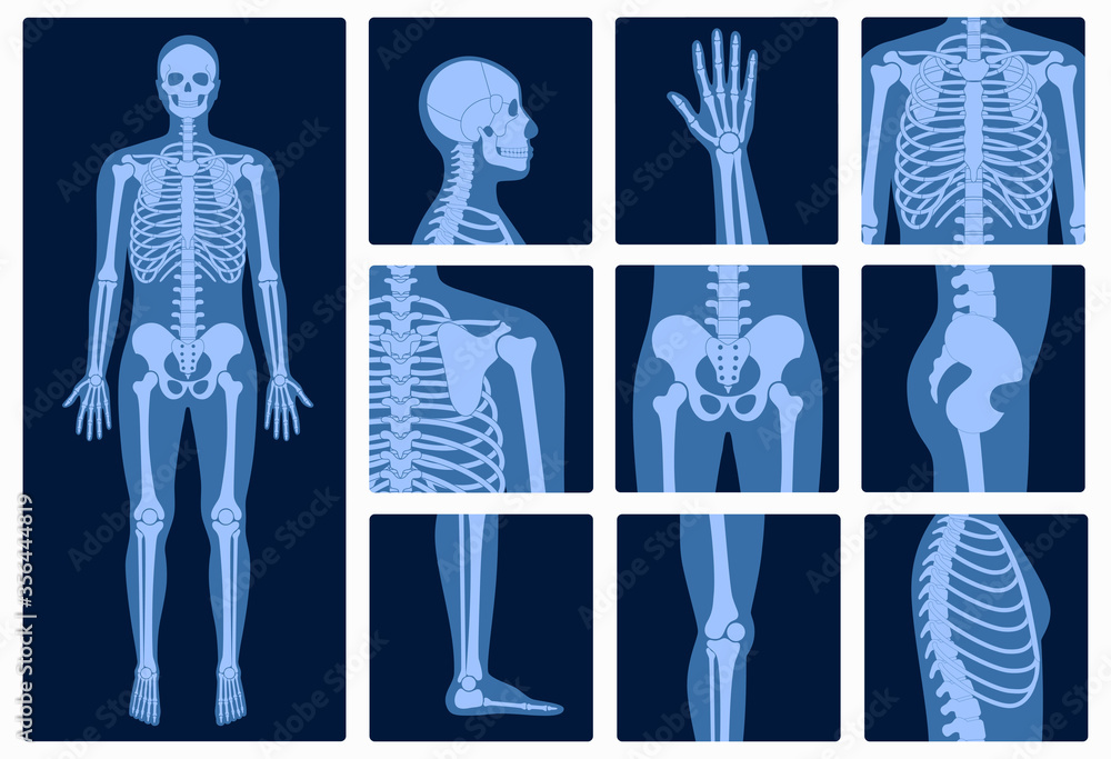 Skeleton x ray Stock Vector | Adobe Stock
