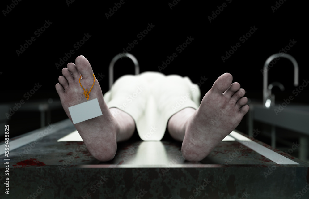 cadaver, dead male body in morgue on steel table. Corpse. Autopsy ...