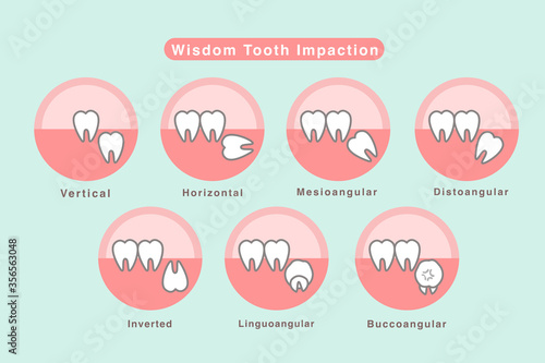 Wisdom tooth illustration Vector.