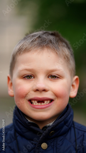 Portrait of a boy with fallen front teeth. Baby smiling