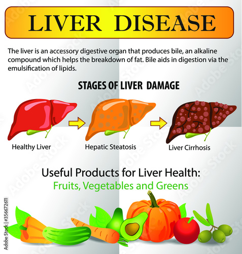 Liver disease infographics. Healthy Foods, liver healthy concept with medicine medical record science vector illustration
