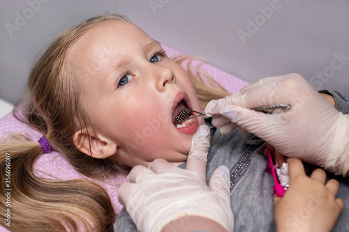 Little girl in class with a speech therapist . The use of special tools for speech correction. photo