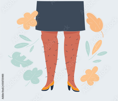 Vector illustration of Hairy legs on white background