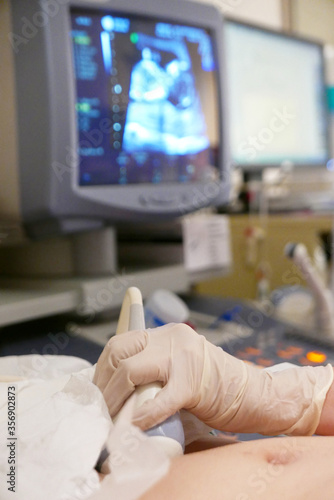 Asian Chinese Mother lying on hospital bed and carrying her newborn