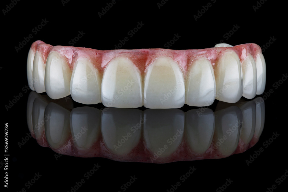 beautiful composition of the dental prosthesis of the upper jaw with a pink gum, shot on black glass with reflection beautiful composition of the dental prosthesis of the upper jaw with a pink gum, shot on black glass with reflection