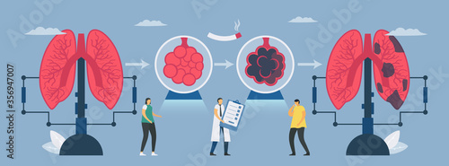 Chronic obstructive pulmonary disease or COPD. Transformation from normal lung to bad lung. Symptoms are breathing problems and poor airflow. Vector illustration in flat design.