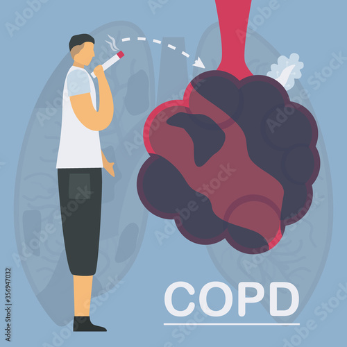 Smoking is cause of chronic obstructive pulmonary disease or COPD. Lung have breathing problems and poor airflow. Vector illustration in flat design.