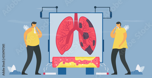 Smoking is cause of chronic obstructive pulmonary disease or COPD. Lung have breathing problems and poor airflow. Vector illustration in flat design.