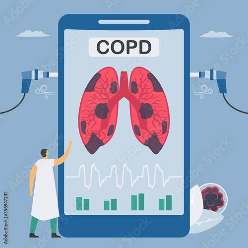 Spirometry is a test used to measure lung function. Chronic obstructive pulmonary disease causes breathing problems and poor airflow. Pulmonology vector illustration.