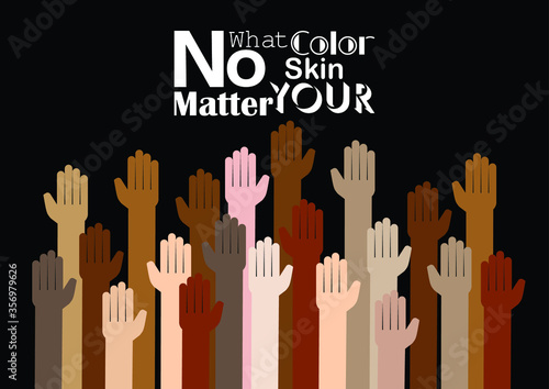 No matter What your Skin Color