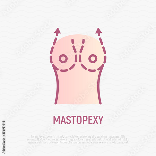 Mastopexy thin line icon. Breast lifting. Modern vector illustration of breast size reduction.