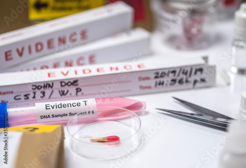  Hematological analysis with forensic test kit in a murder in a crime lab, conceptual image photo