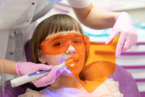 Dentist putting photopolymer seal to little girl teeth. 