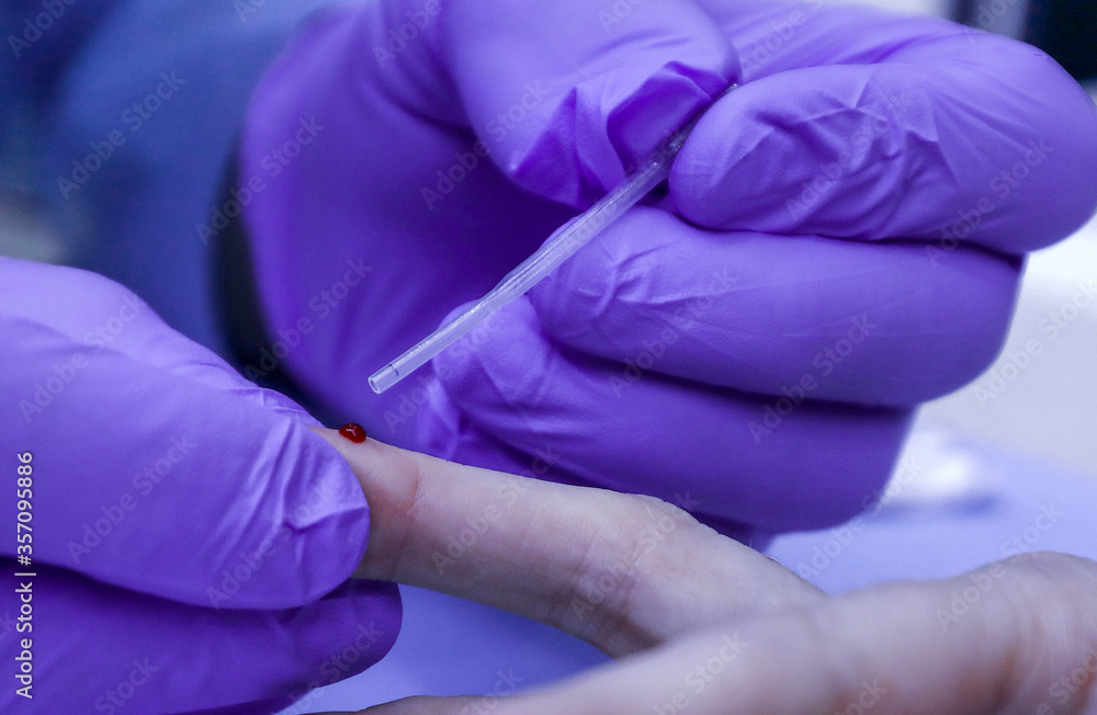 Doctor doing blood collection for analysis on patient. Doctor doing blood collection for analysis on patient.