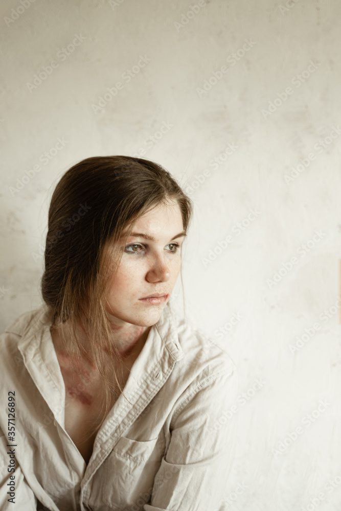 a girl sitting on a white neutral background looks out the window, brightly degenerated beatings on her face and neck, a black eye, a girl with freckles and red hair, domestic violence a girl sitting on a white neutral background looks out the window, brightly degenerated beatings on her face and neck, a black eye, a girl with freckles and red hair, domestic violence