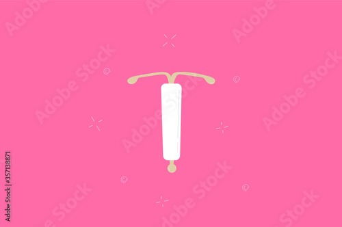 Vector illustration of IUD contraception