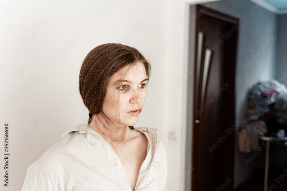 close-up portrait of a girl who has become a victim of domestic violence, stands on a white background, looks at the camera, a girl with freckles close-up portrait of a girl who has become a victim of domestic violence, stands on a white background, looks at the camera, a girl with freckles