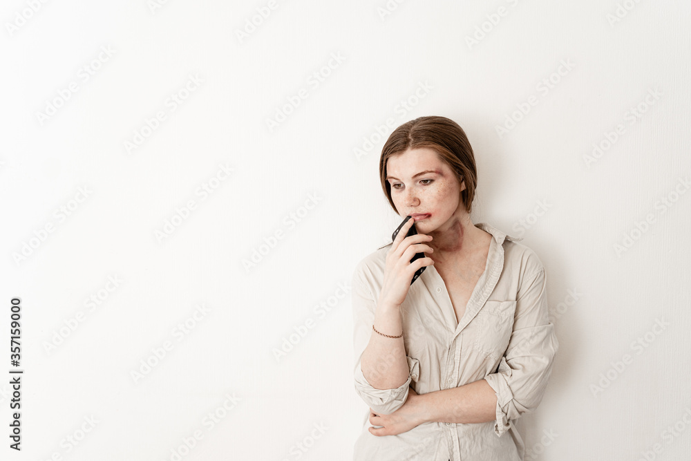 a victim of cruel domestic violence stands on a white isolated background holding a phone in his hands, thinking about a call, fingal under his eye a victim of cruel domestic violence stands on a white isolated background holding a phone in his hands, thinking about a call, fingal under his eye