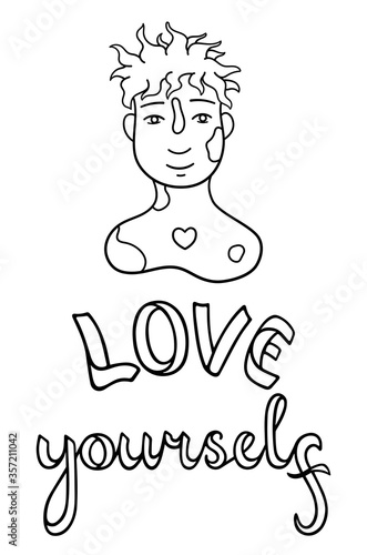 Portrait of boy with vitiligo on his face and shoulders. Love yourself lettering. Body positive.