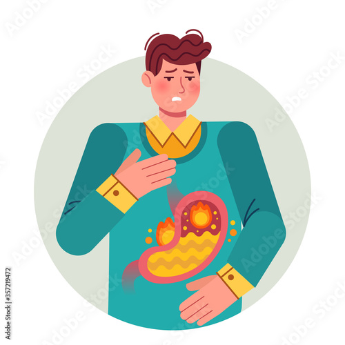 Heartburn. Gastric disease, stomach problem. Ill cartoon man having disease, feeling pain bloating abdomen gastroesophageal reflux or high acidity esophagus, flat vector illustration.