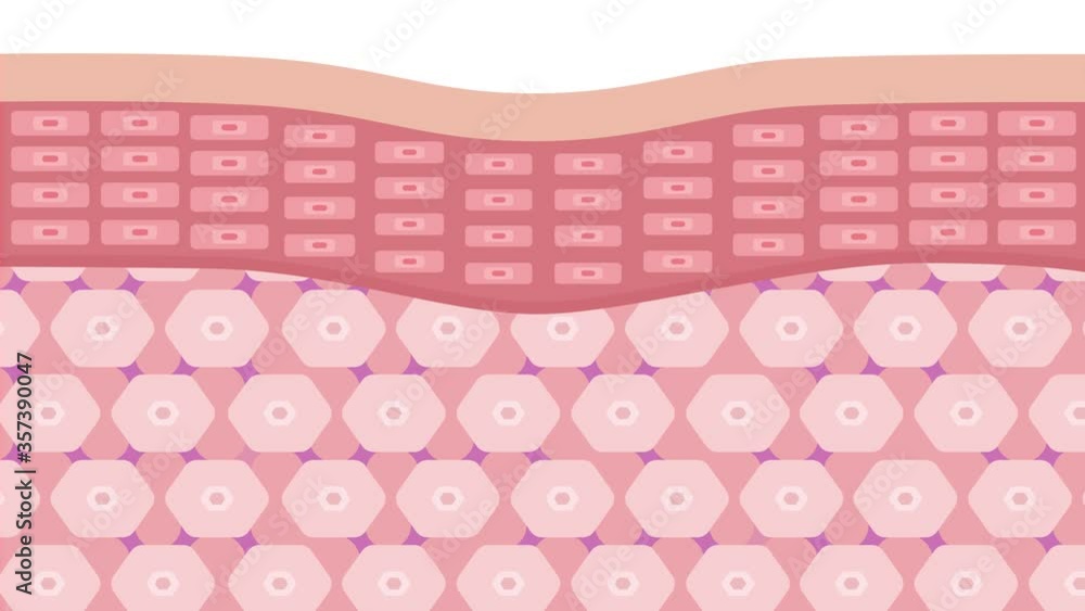 collagen loss in younger skin and aging skin , 3 type collagen skin version graphic animation collagen loss in younger skin and aging skin , 3 type collagen skin version graphic animation