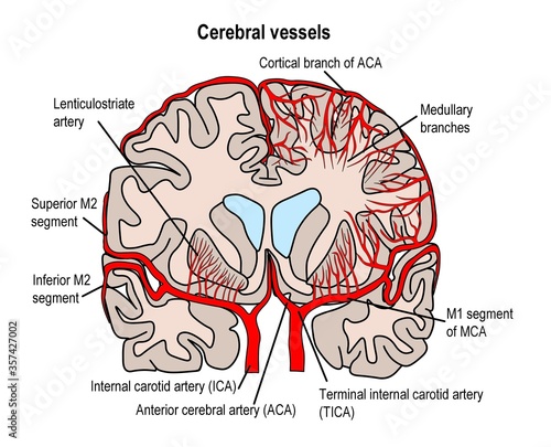 Photography cerebral blood vessel supplying human' brain.