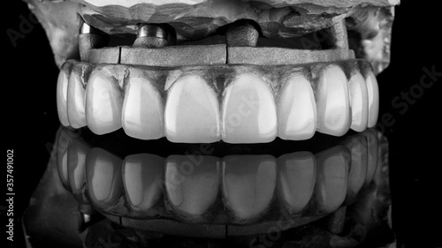 excellent composition of the upper jaw prosthesis on the model and a special metal beam  shot with reflection in black and white style