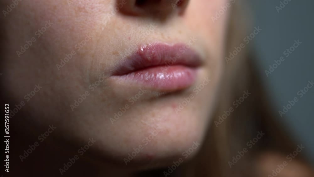 Stressed young woman suffering from herpes sore on her lips, females weak immune system causing herpes sore appearing. Herpes disease and infection concept Stressed young woman suffering from herpes sore on her lips, females weak immune system causing herpes sore appearing. Herpes disease and infection concept