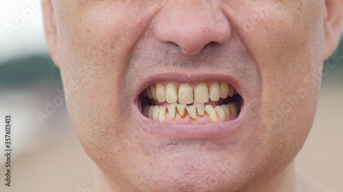 Closeup of angry man face shouting at camera